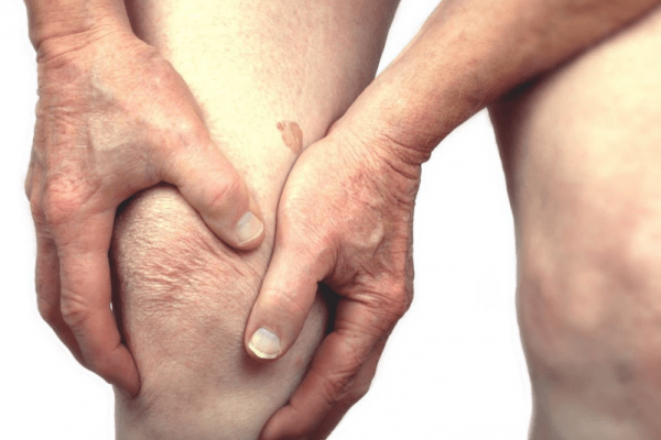arthritis 600x400 - Signs You Might Have Arthritis And How You Can Naturally Treat It