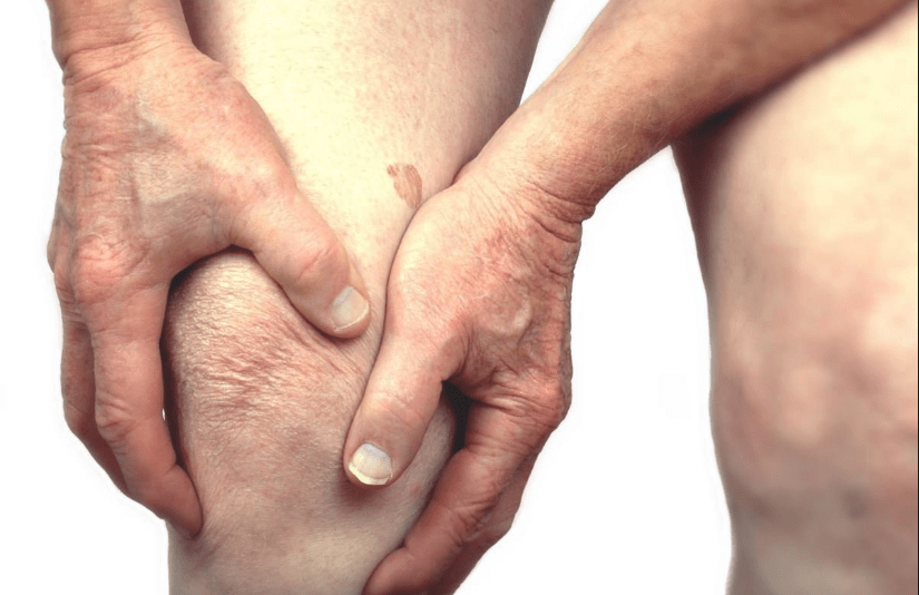arthritis - Signs You Might Have Arthritis And How You Can Naturally Treat It